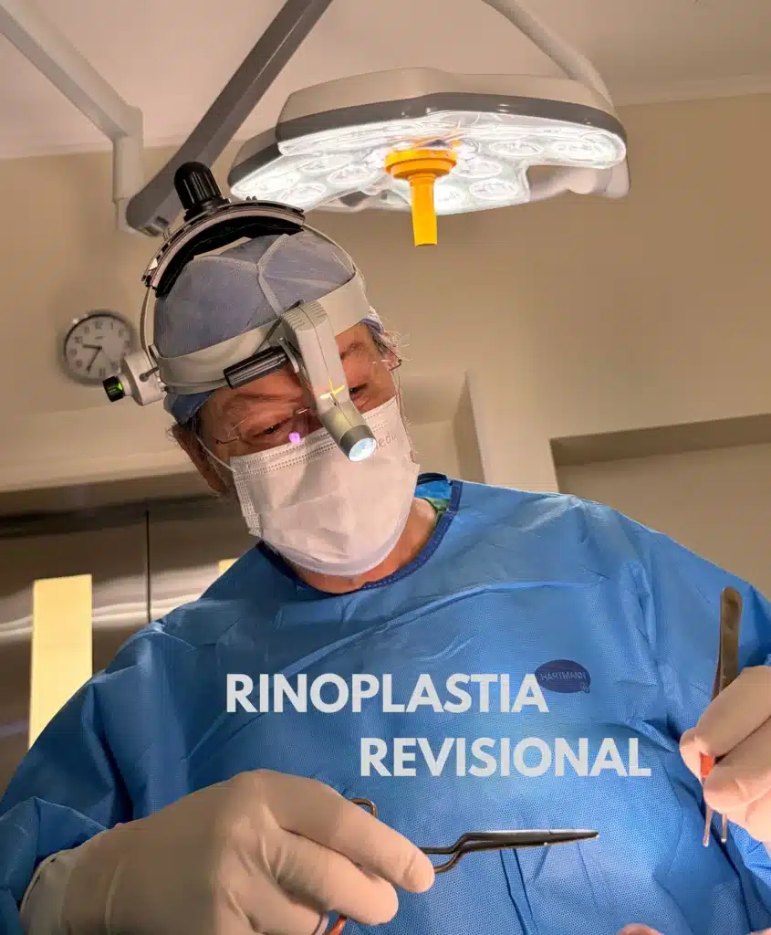 Cirurgião durante procedimento de rinoplastia secundária revisional em centro cirúrgico com Dr Marcelo Zanini
